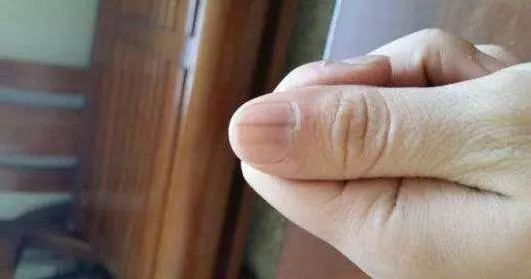 指甲上有豎紋?身體在警告了,多喝一種水,滋補肝腎,把體內毒素排出來,趕緊試試吧