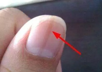 指甲上有豎紋?身體在警告了,多喝一種水,滋補肝腎,把體內毒素排出來,趕緊試試吧