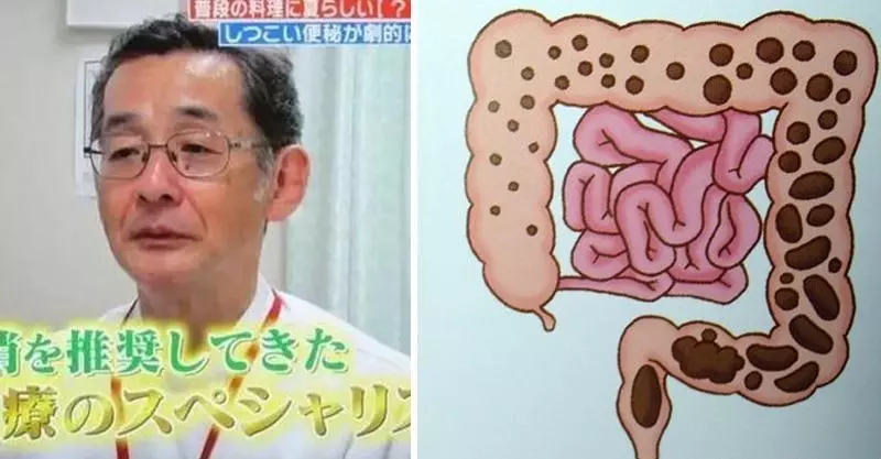 日本專家教你「一個動作」,宿便都清空了,人也變美了!