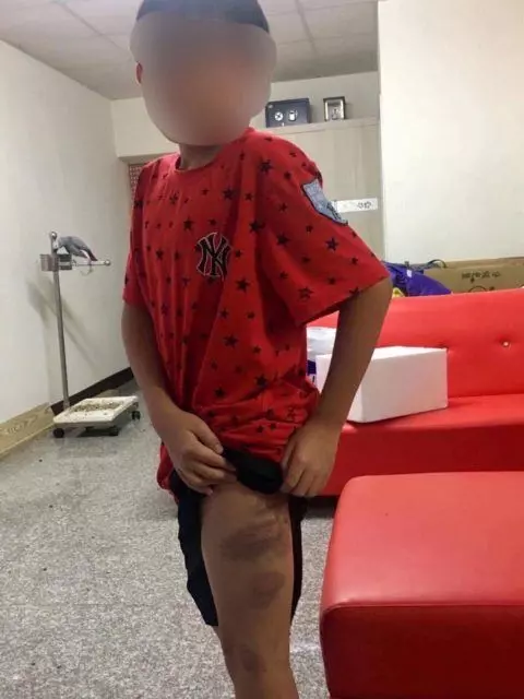 兒子因為「沒考到95分」被媽媽打成小花貓老爸求救,大家看到考卷上的紅字後卻挺媽媽!
