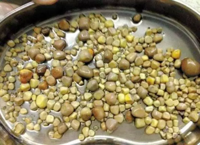 醫生從男子體內夾出「420顆腎結石」震驚全國!醫生夾到手軟:因為他太愛吃這個