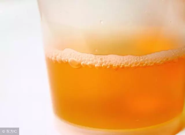 腎臟出問題?4項檢查 3大飲食禁忌 不看就糟了