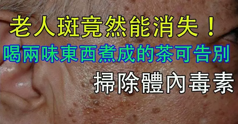 老人斑!喝廚房裡的「兩味東西」煮成的茶可告別,掃除體內毒素,使健康光潤,推遲肌膚變老哦!