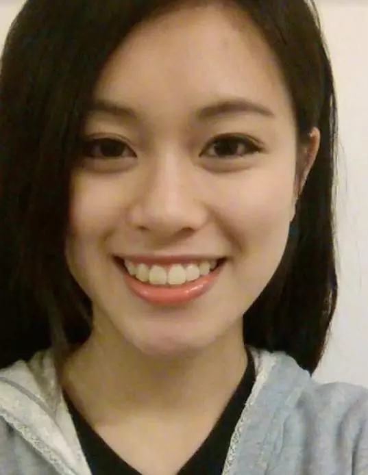 女子為男友整容30次!男友洗腦式說教太恐怖,酸完臉酸她胸小!