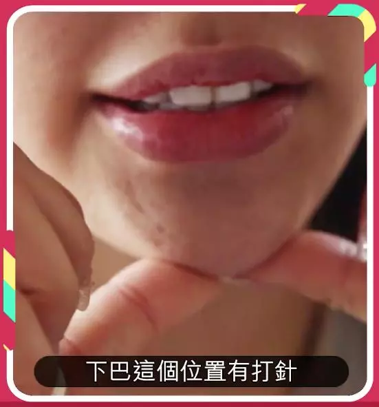 女子為男友整容30次!男友洗腦式說教太恐怖,酸完臉酸她胸小!