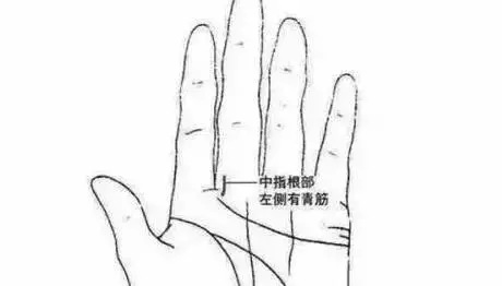 腦血栓自救保命方法,只需刮這條「青筋」