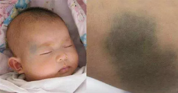 孩子屁屁上的青色胎記,原來是選妳當媽媽留下的代價!