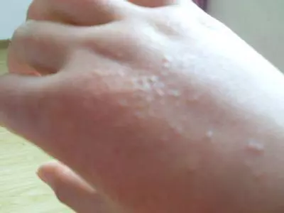 身上濕氣重的人,不要常吃這些蔬果!