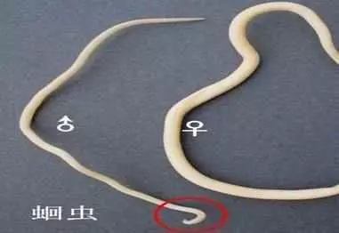 出現這五個信號,體內有大量蛔蟲!千萬別忽視!