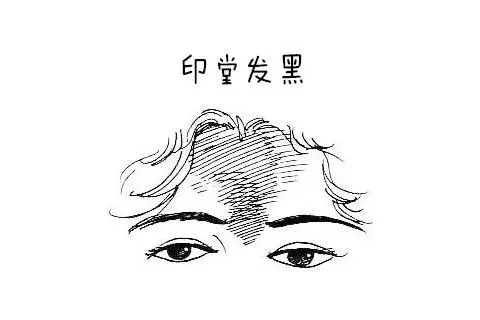 凶兆來臨前額頭會出現「這東西」! 這時出門一定要小心!恐有意外發生!