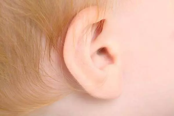 注意!你家寶寶耳朵上有這種小孔嗎?如果有,就要小心了!!!