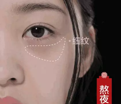 延遲皺紋的方法,除皺紋實用妙法及消除皺紋的飲食