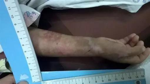 20歲狠繼父 凌虐2歲女童致死