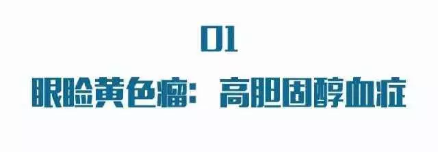 眼睛出現這種改變,是中風的前兆!千萬別忽視!