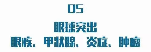 眼睛出現這種改變,是中風的前兆!千萬別忽視!