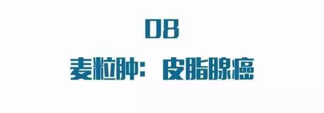 眼睛出現這種改變,是中風的前兆!千萬別忽視!