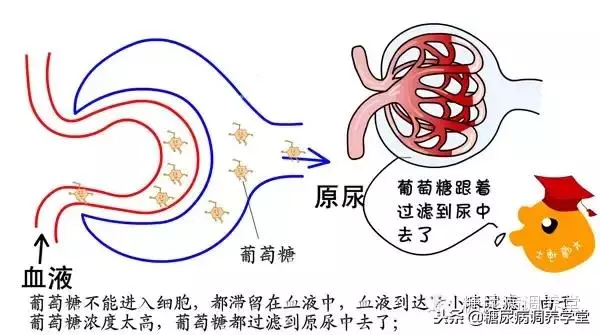 血糖」與「尿糖」——您未必了解的真相