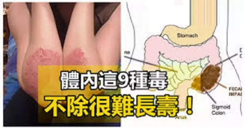過了40歲,體內這9種毒,不除很難長壽!排出陰毒,健康少病,延年益壽!