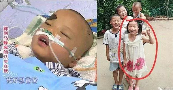 「爸爸,我不治了,給我買雙新鞋和一身新衣服就好。」 8歲女童被馬蜂群蜇,求家人放棄!…