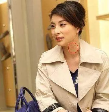 激情過度「留吻痕」的6位女星,而最後一個未婚也有?太尷尬……