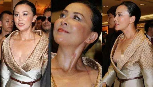 激情過度「留吻痕」的6位女星,而最後一個未婚也有?太尷尬……