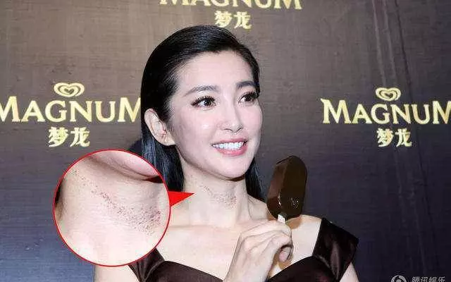 激情過度「留吻痕」的6位女星,而最後一個未婚也有?太尷尬……