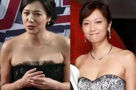 腋下「這塊肉」害你明明很瘦上半身卻顯厚 5個運動讓你美秀肩膀不用怕