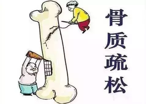 骨質疏鬆不用花大錢買保健品! 只要做好3件事 , 50歲擁有18歲的骨骼 !