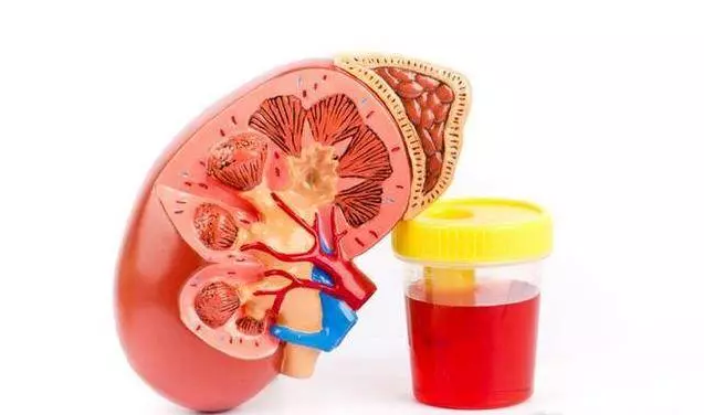 7種水果是腎臟「最愛」!腎不好的人,請多吃,男女都管用