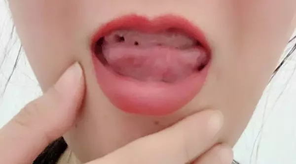 我知道我很蠢!覺得阿嬤假牙美 妙齡女拔光牙齒後悔莫及