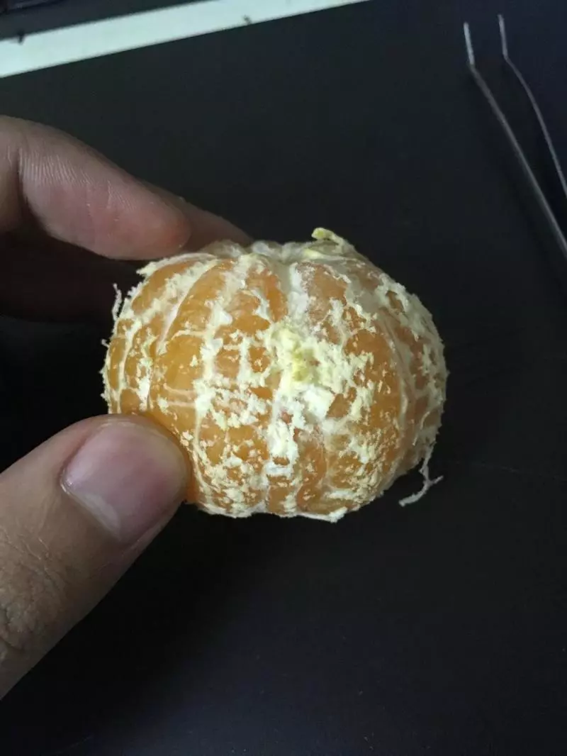橘子「極限去筋」療癒慘!抄鑷子修行整天 警告:內容將引起舒適