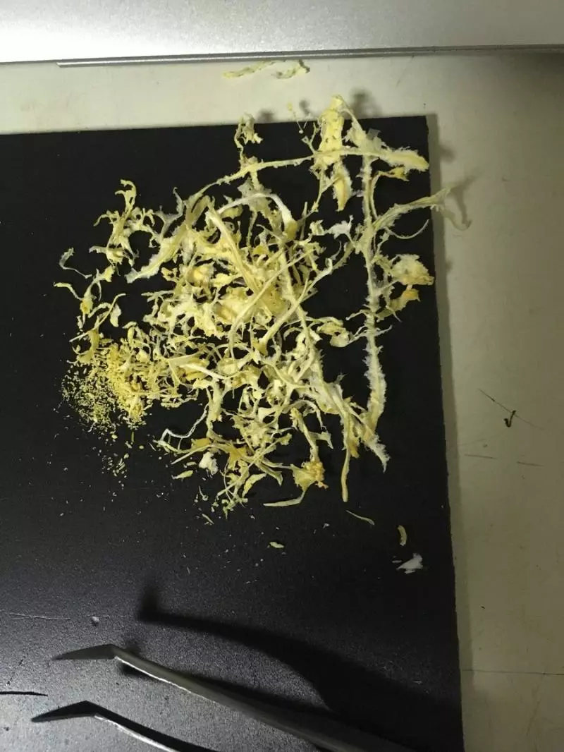 橘子「極限去筋」療癒慘!抄鑷子修行整天 警告:內容將引起舒適