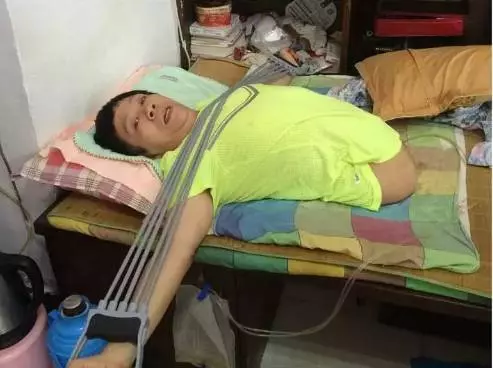 他被10噸大貨車腰斬,截肢後身高只剩78公分,59歲的他如今變成這樣!讓人萬萬沒想到!