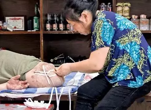 他被10噸大貨車腰斬,截肢後身高只剩78公分,59歲的他如今變成這樣!讓人萬萬沒想到!