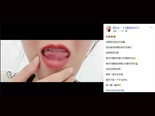 看到奶奶假牙很美 正妹竟找密醫拔光整口牙 !