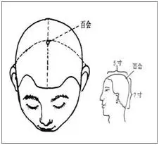老年人常忘事?醫生介紹,艾灸這3穴,簡單有效提高記憶力!