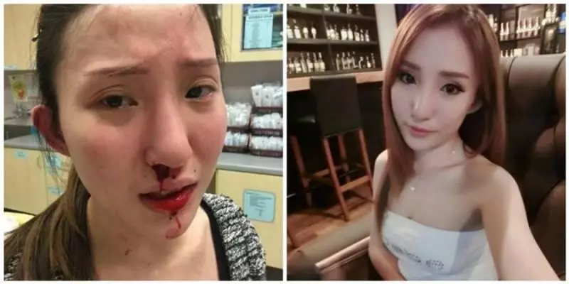 令人憤怒~向外人借錢救小寶寶,大馬紅人卻遭老公爆打