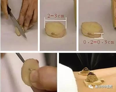 春天巧用這穴位,對養陽大有益處!(附操作手法)