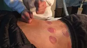 春天巧用這穴位,對養陽大有益處!(附操作手法)