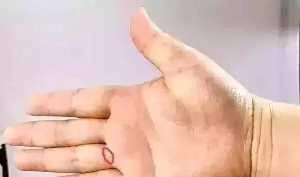 手上有個萬能穴位,每天都按一按,血管通暢心情好!