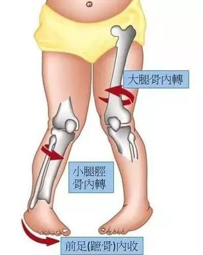 這8個壞習慣讓很多孩子「越長越醜、越來越笨」,父母一定要及時糾正