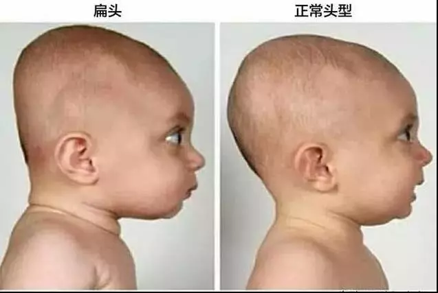 這8個壞習慣讓很多孩子「越長越醜、越來越笨」,父母一定要及時糾正