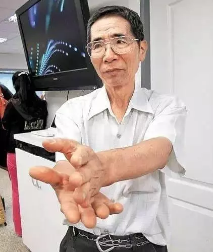 台灣名中醫,靠兩招治百病,不要一分錢!