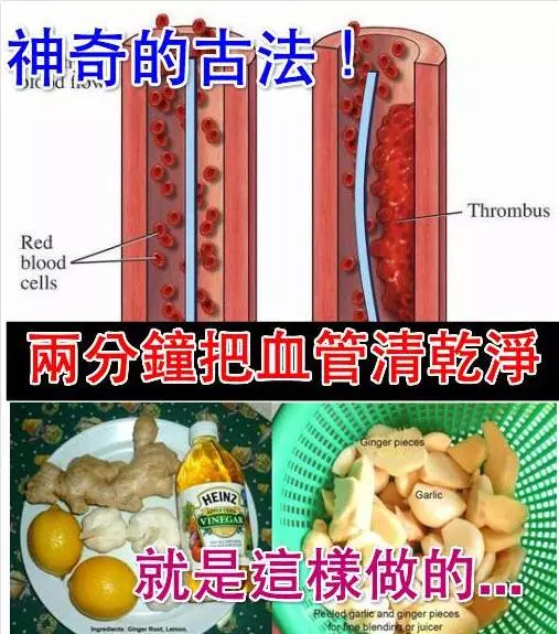 通血管的古方,花2分鐘就能給父母和親朋好友的超級大禮!
