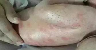 通血管的古方,花2分鐘就能給父母和親朋好友的超級大禮!