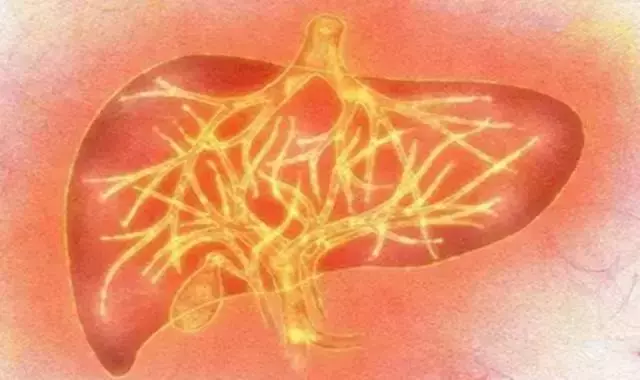 春主生髮,應肝,是艾灸養肝、調理肝火旺的大好時機!