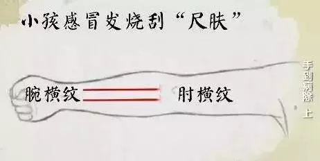 感冒、咳嗽、高燒,這樣刮一刮,就完事!收了吧!