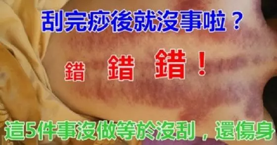 刮完痧就沒事了?錯錯錯!中醫師叮嚀:5件事沒做等於沒刮、超傷身