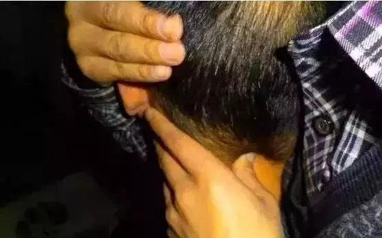 全套整脊手法彙總,收藏!