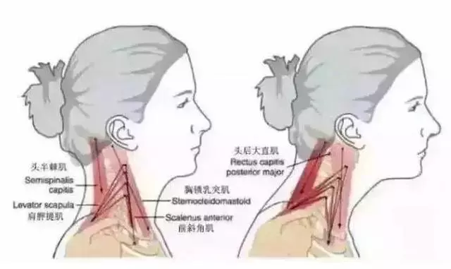 肩頸疼痛受不了,放鬆肩頸身體好